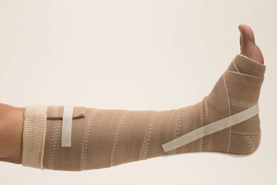 Vascular Elastic Wrap